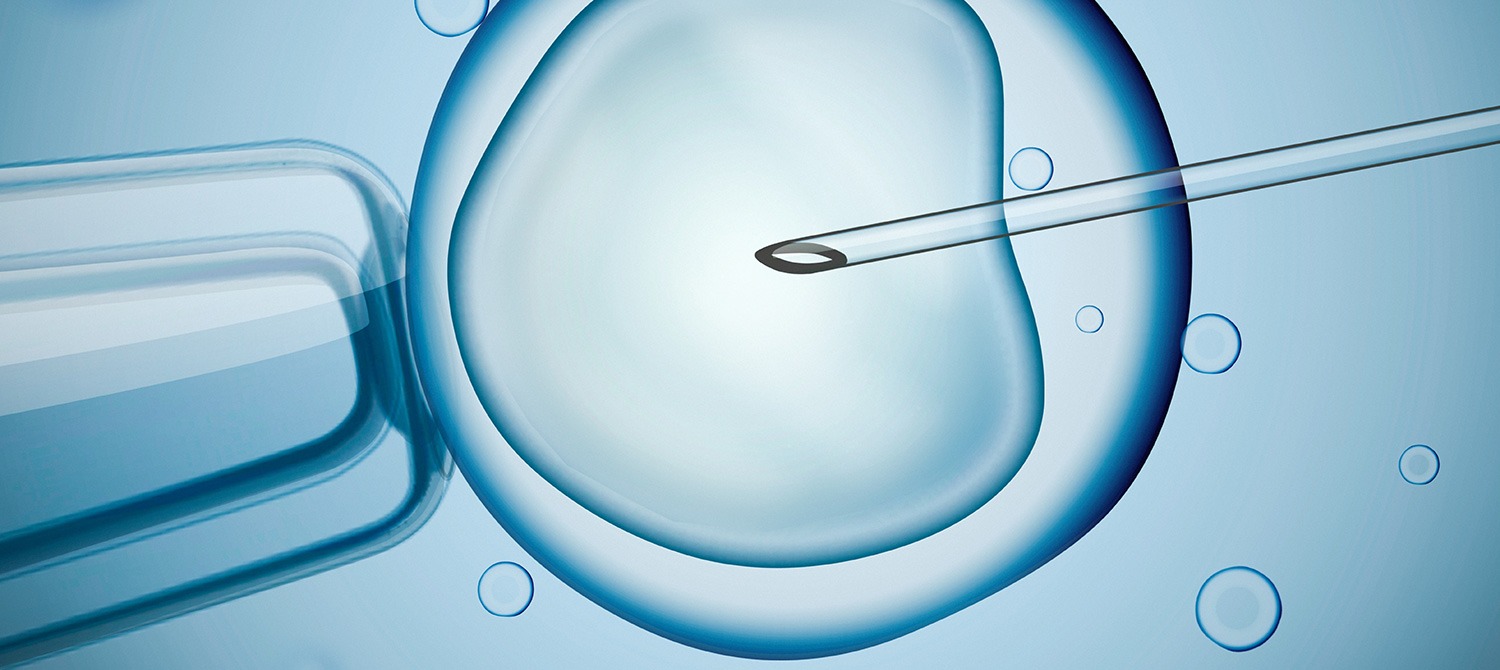 IVF_ICSI