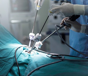 Laparoscopic_Surgery