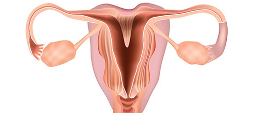 Uterine_Abnormalities